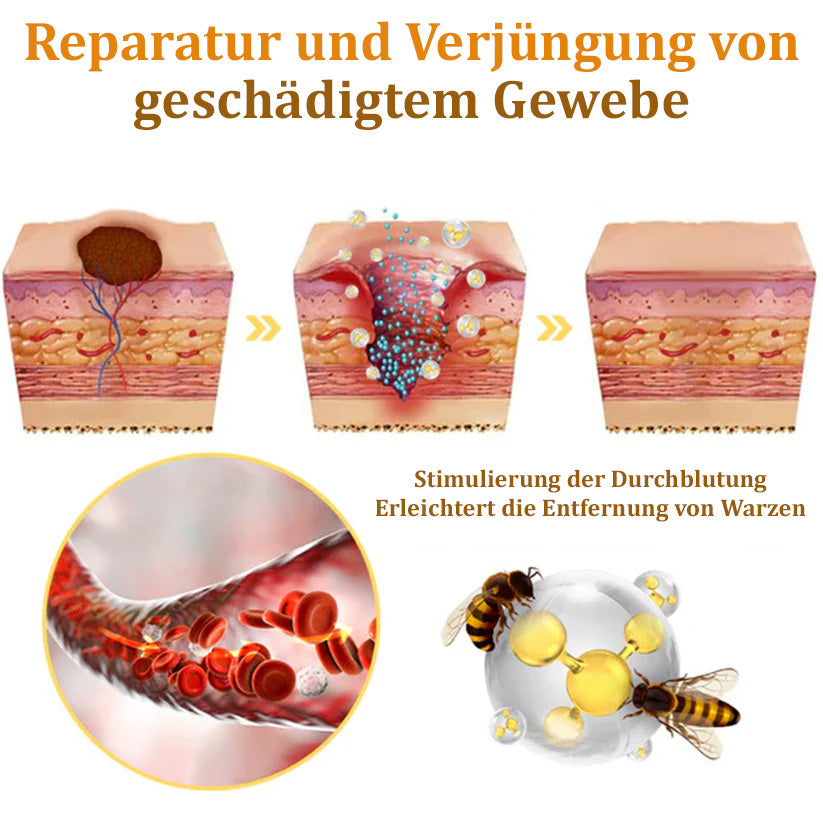 ✅🌟BfArM-zertifizierte | flysmus™ Bienengift-Hautanhängsel-Entfernungscreme👨⚕️